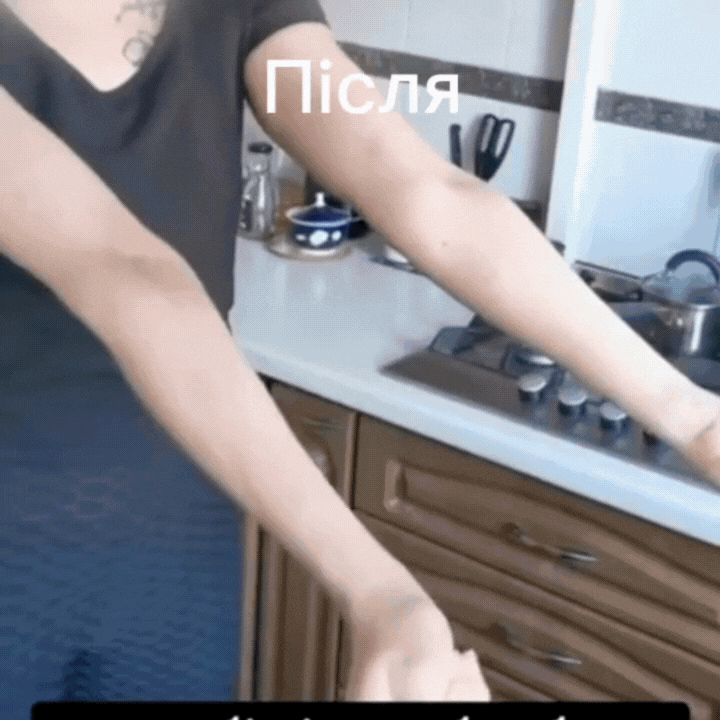 Положення стопи після реабілітації